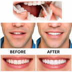 Removable Denture Adjustable Fit Reusable Natural Looking
