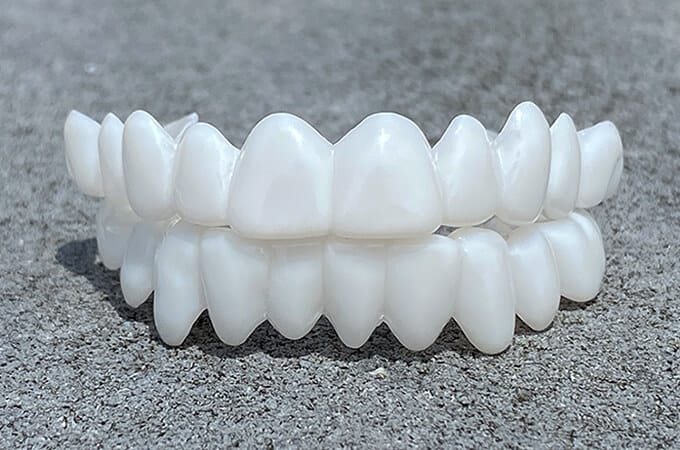 Removable Veneers Custom Fit Natural Look & Reusable