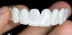 Removable Veneers Custom Fit Natural Look & Reusable