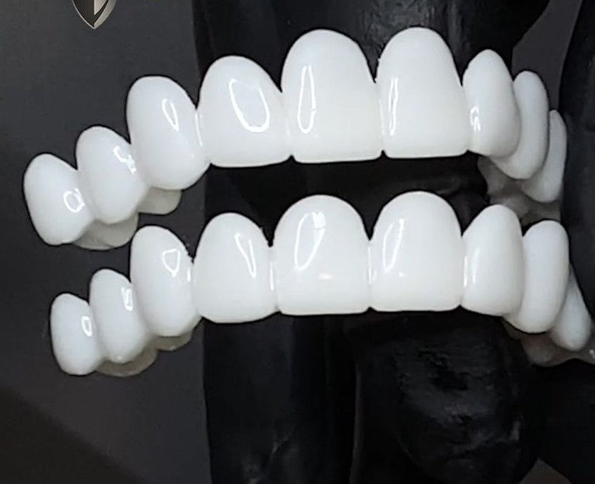 Removable Veneers Custom Fit Natural Look & Reusable