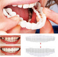 Removable Veneers Set Natural-Looking Acrylic Resin