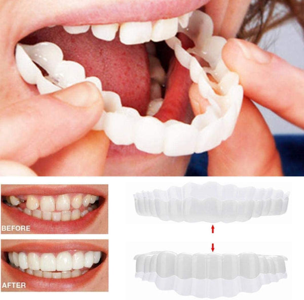 Removable Veneers Set Natural-Looking Acrylic Resin
