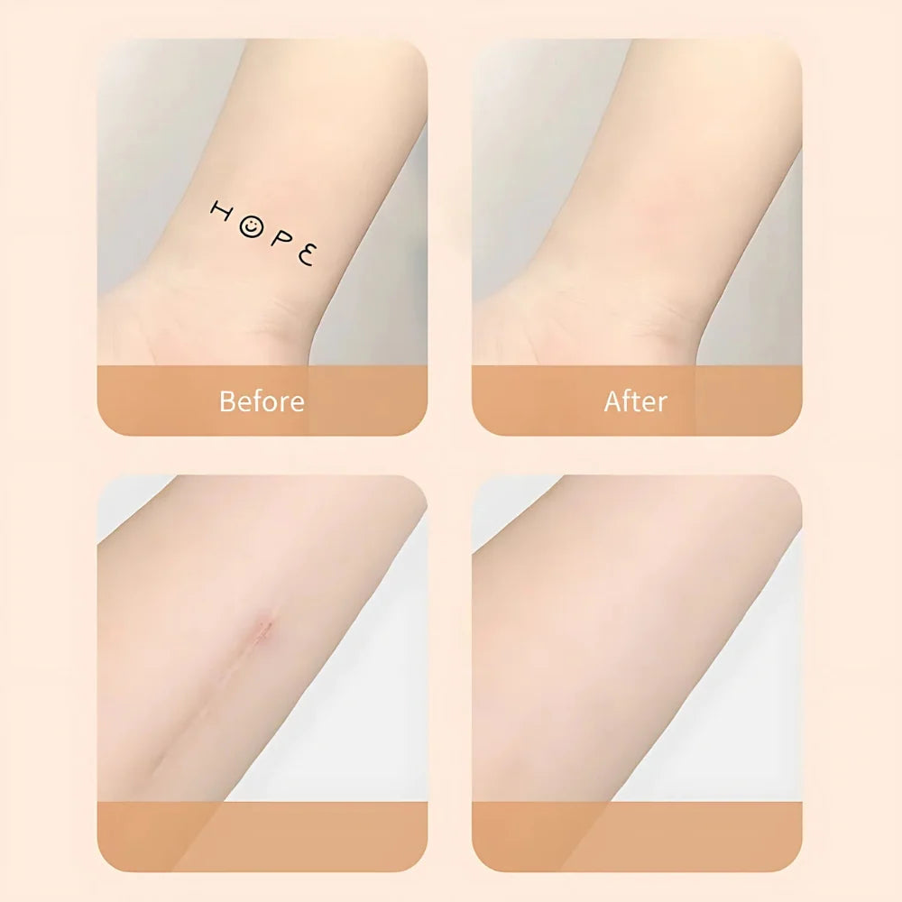 Scar & Tattoo Patches Ultra-Thin Water-Resistant 6 Pieces