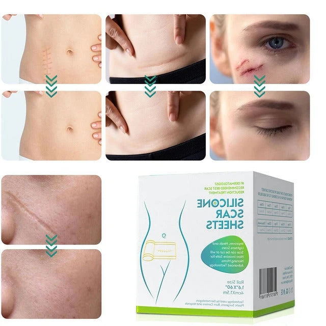 Silicone Scar Sheet Cut-To-Fit Reusable 12-Hour Wear
