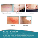 Silicone Scar Sheet Cut-To-Fit Reusable 12-Hour Wear