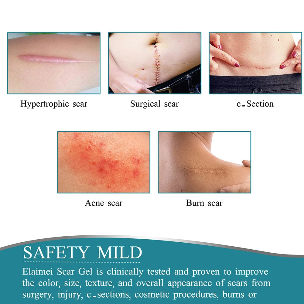 Silicone Scar Sheet Cut-To-Fit Reusable 12-Hour Wear
