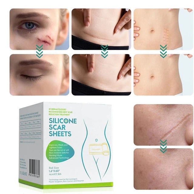 Silicone Scar Sheet Water-Resistant Reusable Cut To Fit