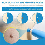 Skin Spot Remover Precision Tip Compact & Ergonomic