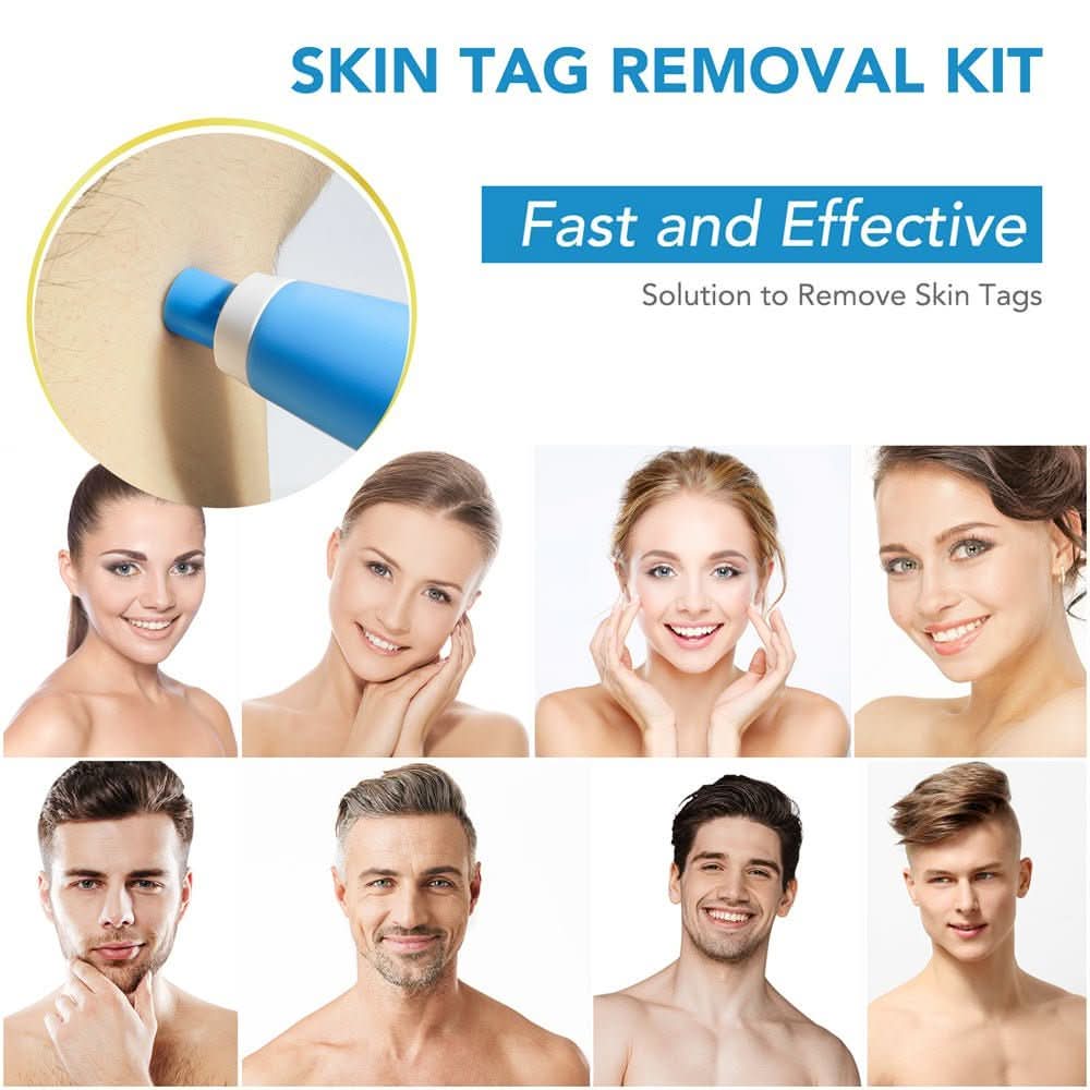 Skin Spot Remover Precision Tip Compact & Ergonomic
