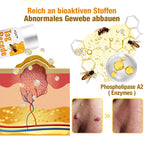 Skin Spray Bee Venom Targeted Spot & Wart Treatment