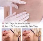 Skin Tag & Mole Remover Gentle Plant-Based 3ml