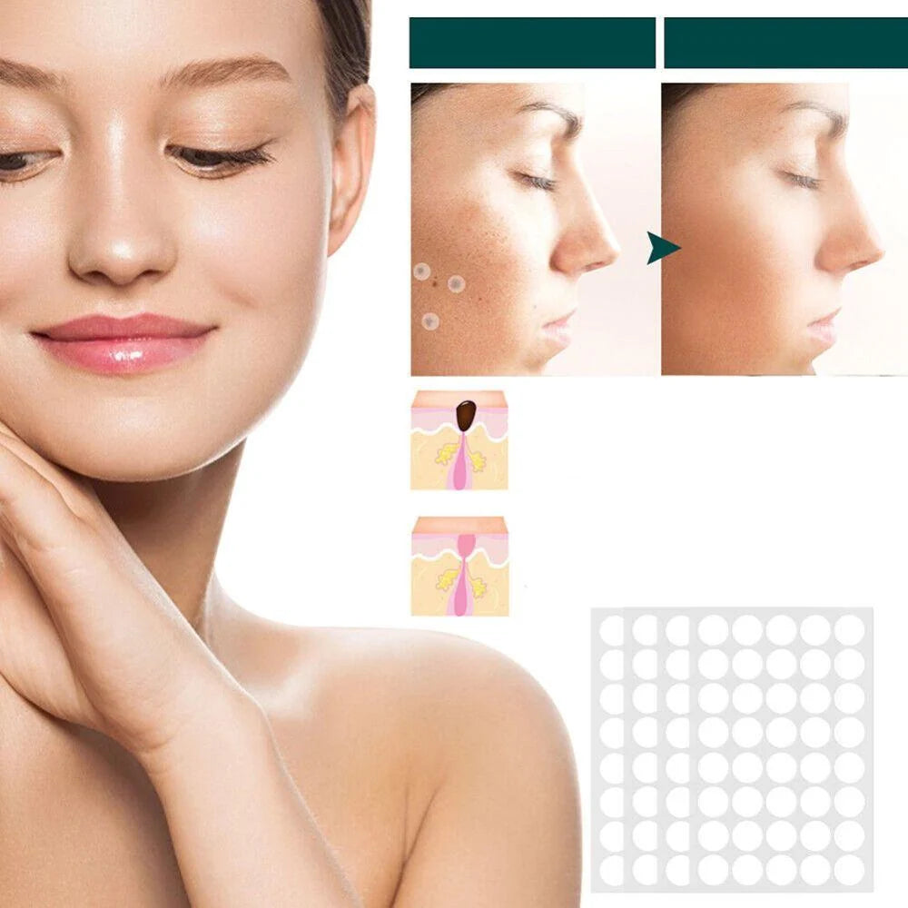 Skin Tag & Wart Patches Hydrocolloid Hypoallergenic 120 Pieces