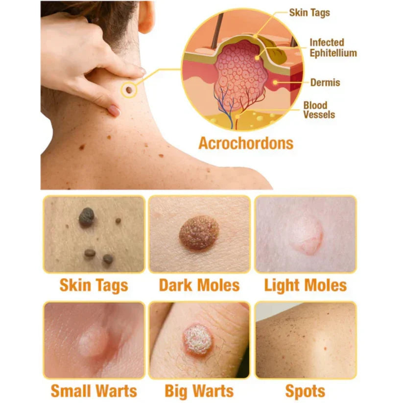 Skincare Spray Bee Venom Bioactive Precise Applicator