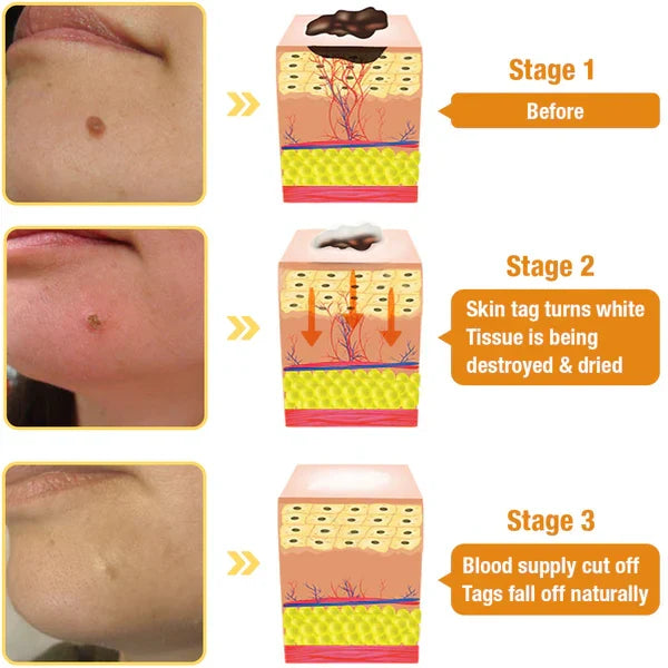 Skincare Spray Bee Venom Bioactive Precise Applicator