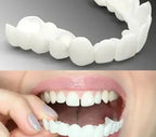 Snap-On Dentures Flexible Fit No Adhesive