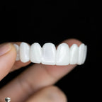 Snap-On Veneer Adjustable Fit Lightweight & Reusable