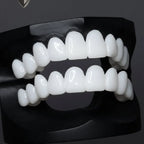 Snap-On Veneer Adjustable Fit Lightweight & Reusable
