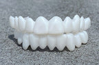 Snap-On Veneer Custom-Fit Natural-Looking Reusable