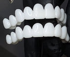 Snap-On Veneer Custom-Fit Natural-Looking Reusable