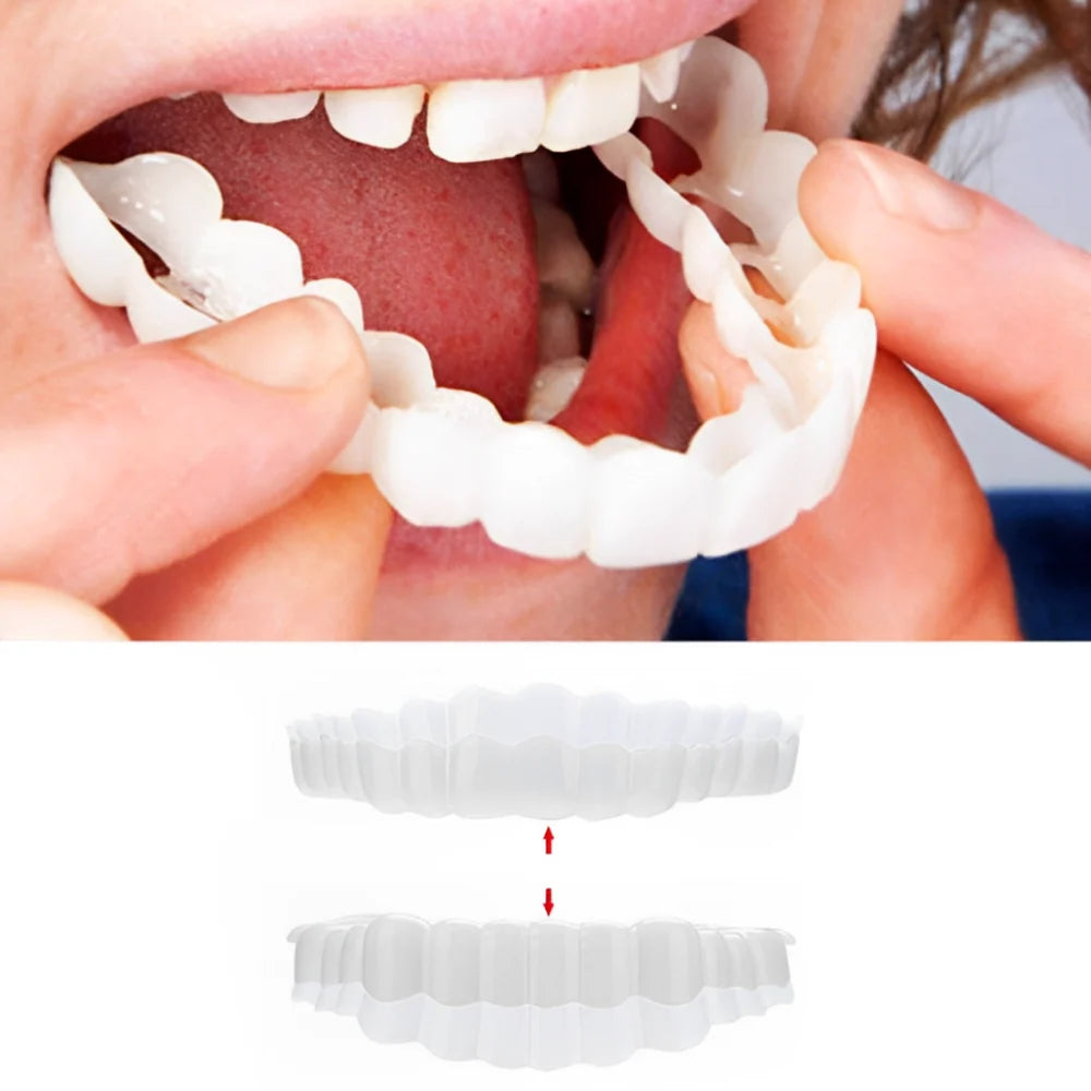 Snap-On Veneers Instant Reusable Upper & Lower