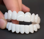 Snap-On Veneers Removable Lightweight Natural-Look Resin
