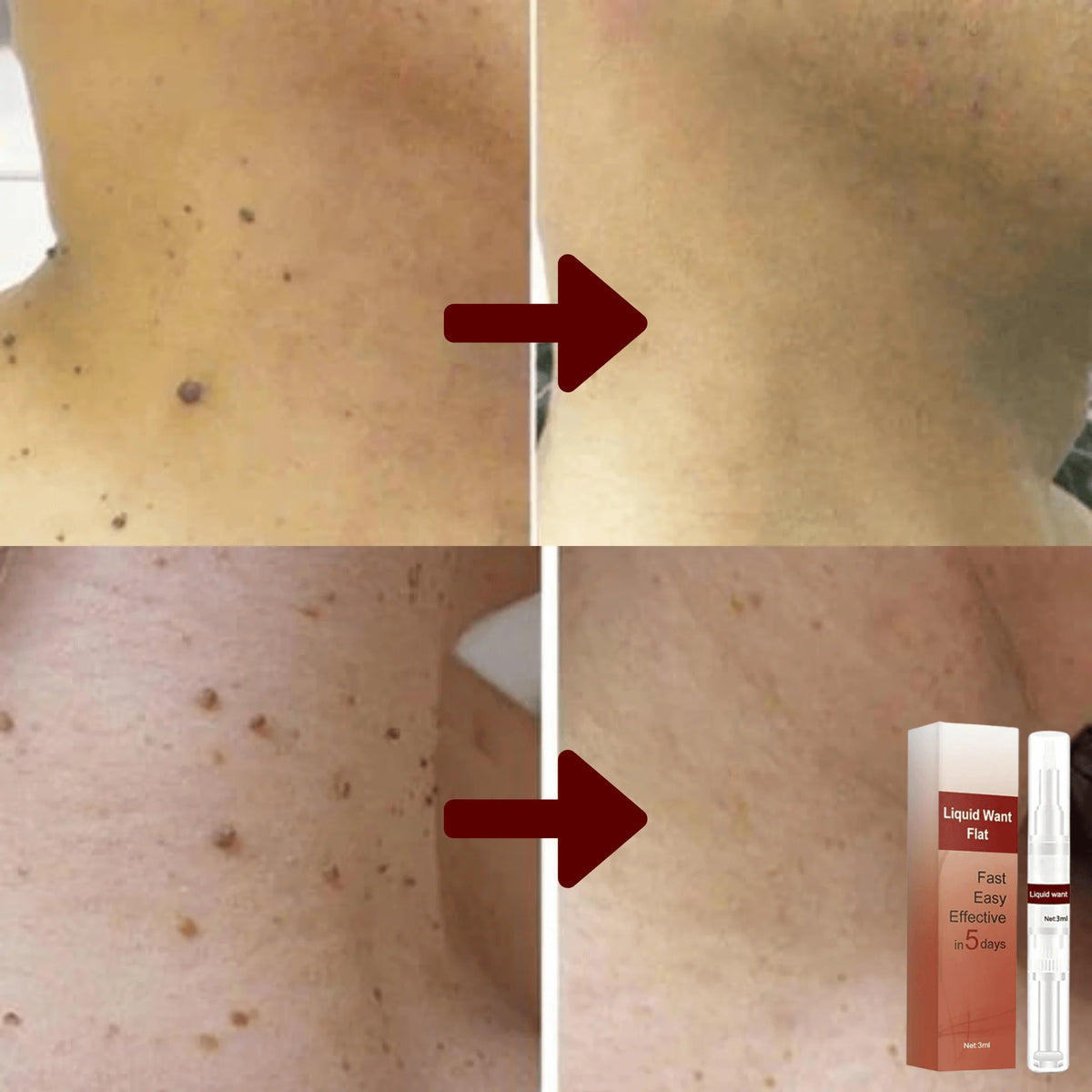 Spot-Correcting Serum Plant-Based & Fast-Absorbing
