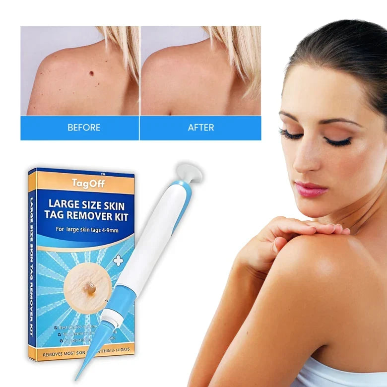 Spot Treatment Precision Applicator & Plant Extracts 30ml