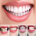 Teeth Alignment Trays 3-Step Progressive Universal Mold & BPA-Free