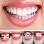 Teeth Alignment Trays Three-Step Universal Fit BPA-Free