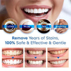 Teeth Whitening Pen Pocket-Sized Precision & Gentle Formula