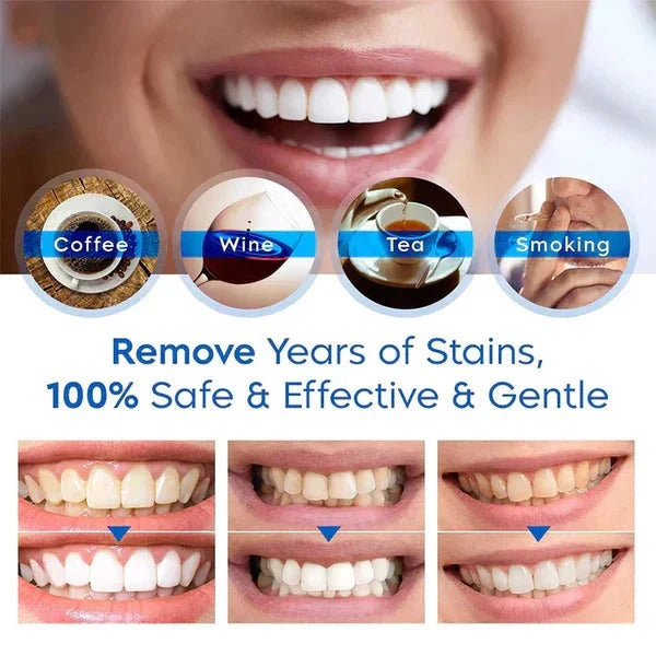 Teeth Whitening Pen Pocket-Sized Precision & Gentle Formula