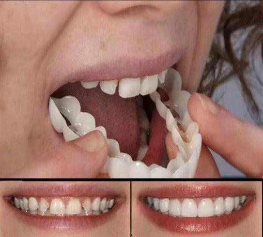 Temporary Denture Flexible Silicone Natural-Looking & Universal Fit
