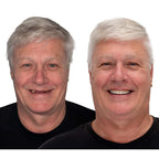 Temporary Dentures Soft Cushion Snap-In Upper & Lower Set