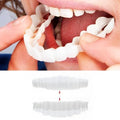 Temporary Smile Cover Upper & Lower Warm-Water Fit