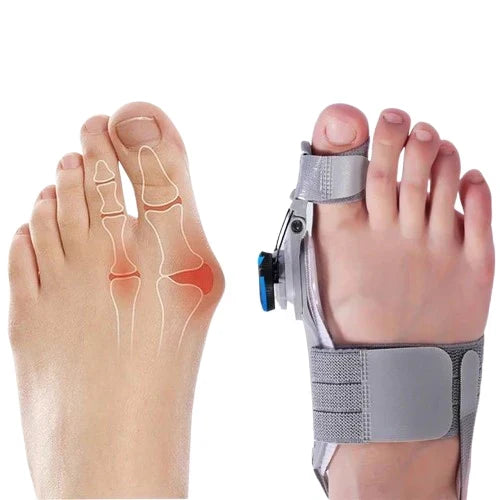 Toe Corrector Adjustable 3D Knob & Silicone Cushions