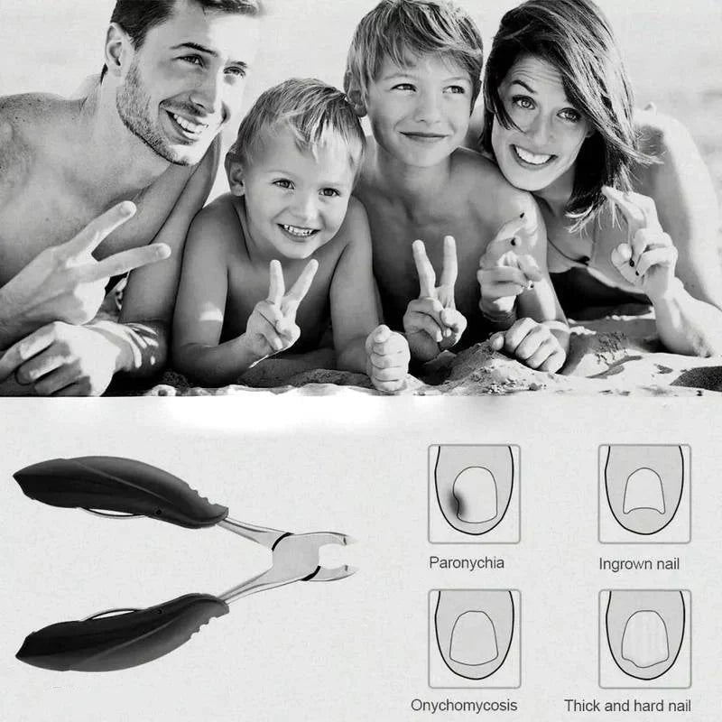 Toenail Clipper High-Leverage Curved Stainless Steel Ergonomic Non-Slip Handle