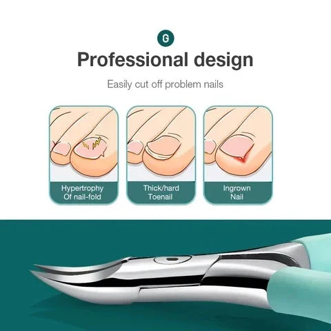 Toenail Clippers Ergonomic Non-Slip Handle Surgical-Grade Stainless Steel