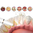Tooth Cleaner Ultrasonic Cordless Rechargeable & Gentle On Gums