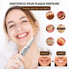Tooth Cleaner Ultrasonic USB Rechargeable Three Modes