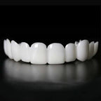 Veneers Custom-Fit At Home Removable & Reusable