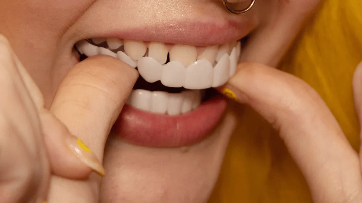 Veneers Custom-Fit At Home Removable & Reusable