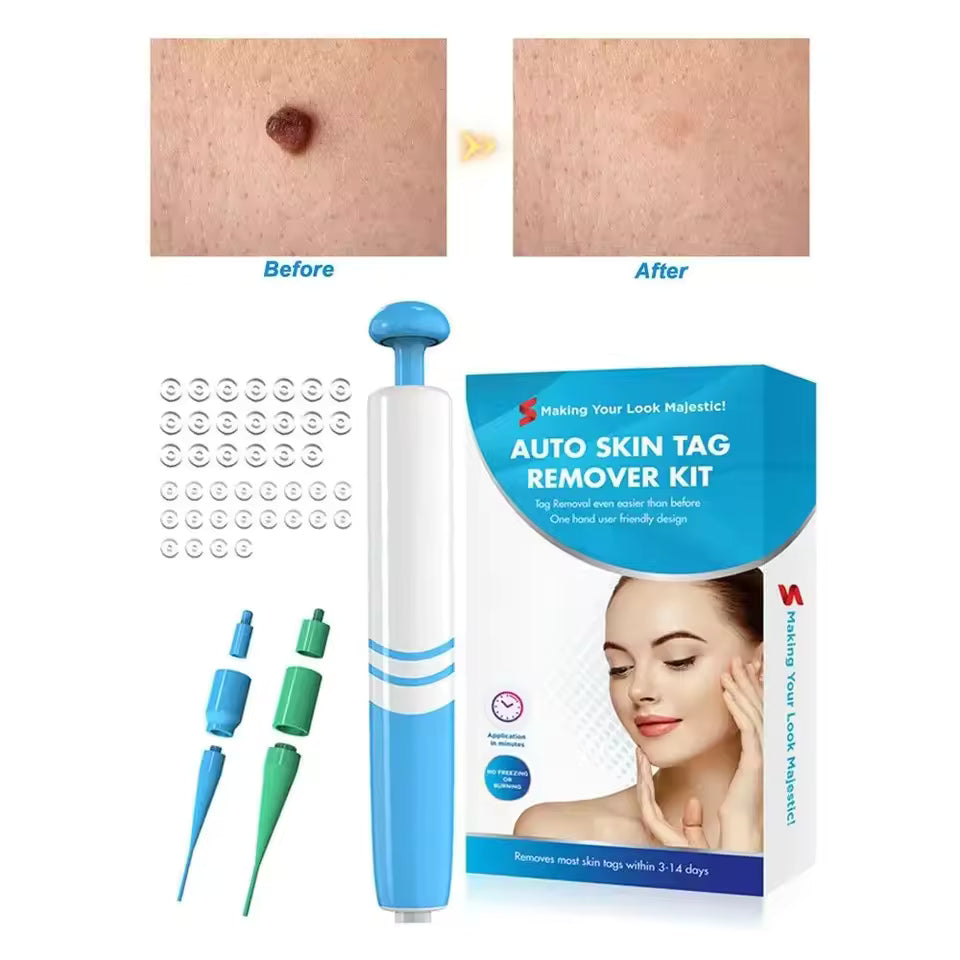 Wart & Mole Remover Topical Non-Invasive 50 ml