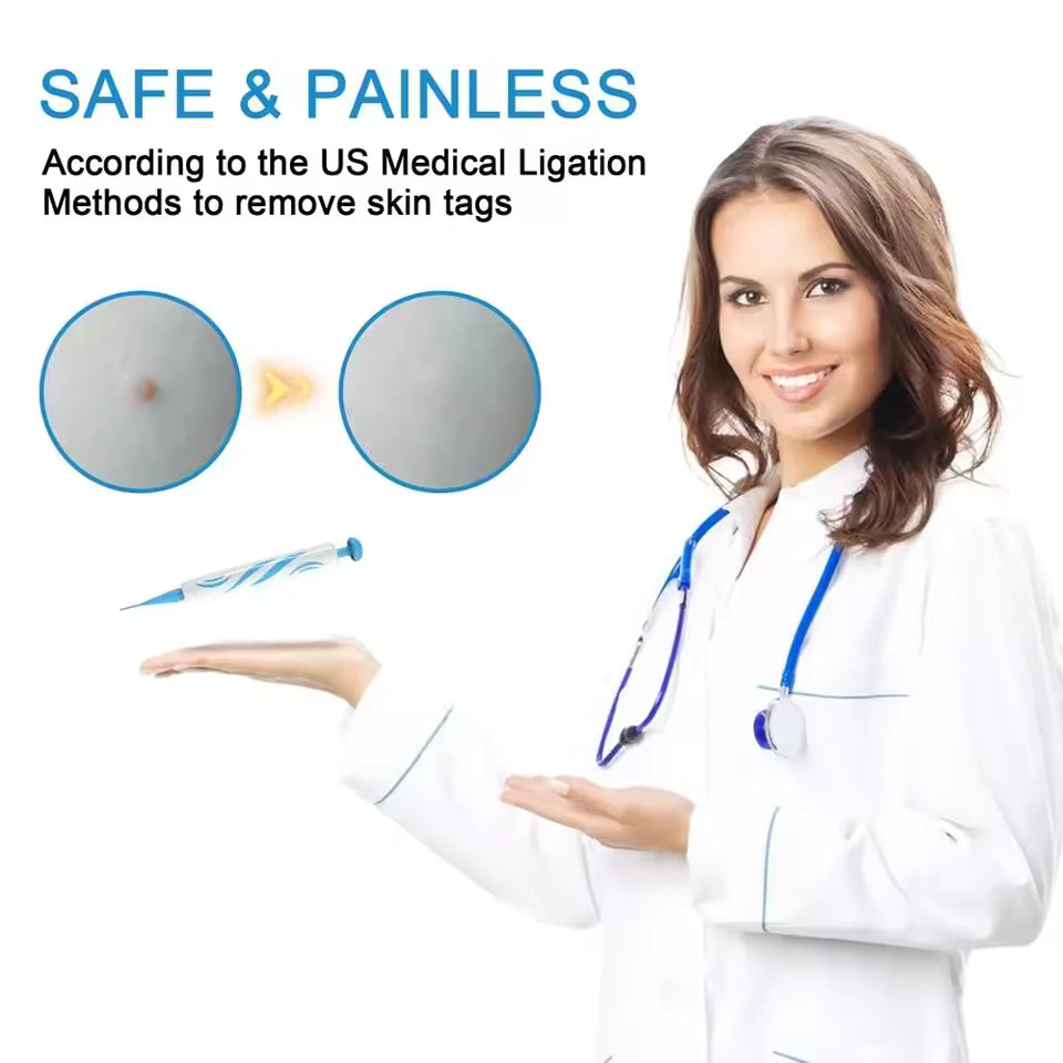 Wart & Mole Remover Topical Non-Invasive 50 ml