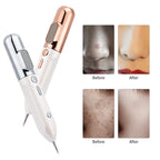 Plasma Skin Rejuvenation Pen Fine Tip 9 Levels